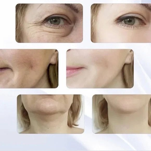 7 Color Beauty Device for Face & Neck – LED Skincare Massage Tool NEW - Picture 8 of 10